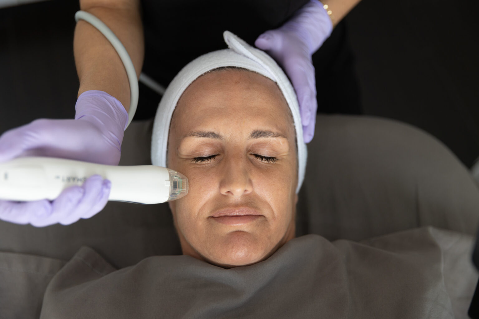 Microneedling Near Avon Park, FL | Florida Lakes Spa Sebring